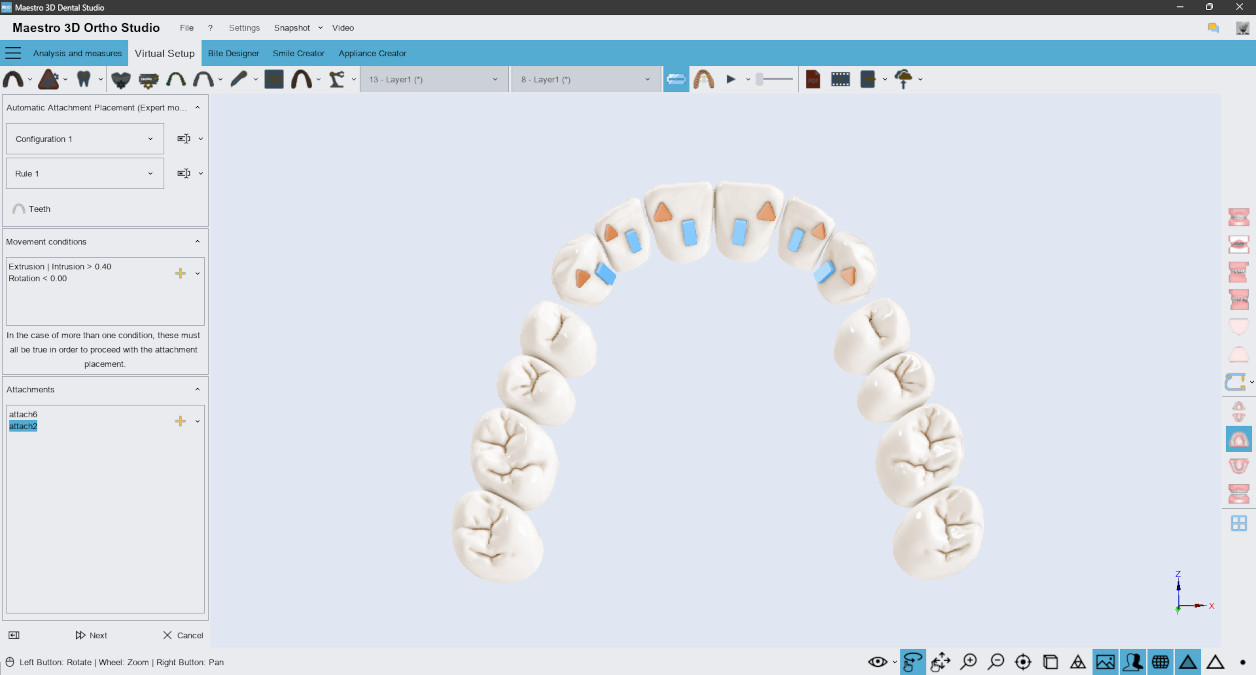 Deltaface, ArchForm, ONYXCEPH, 3Shape Ortho System, 3Shape Clear Aligner Studio, NemoCast, Nemotec, Ortho X Aligner, diorco, dentOne, 3dLeone, 3D Leone Designer, SureSmile Aligner, ulab, ulabsystems, blue sky bio, Maestro 3D, M3D, AGE Solutions, MDS500, Best orthodontic software, Bracket placement software, Digital study models, Rapid prototyping for dentistry, 3D scanner for jewelry, Dental scanner, Best dental scanner, Orthodontic software for clear aligners, Digital design of clear aligners, Orthodontic CAD/CAM software, Rapid prototyping for orthodontics, Guide for aligner production, Dental aligner software solutions, Digital creation of orthodontic appliances, 3D modeling for dental aligners, Direct 3D printing of clear aligners, Orthodontic correction software, Advanced technology for aligners, Software for expander design, Automatic aligner cutting, Ortho Studio Software, Dental Studio Software, Digital bands and expanders, Digital bite splint, Digital mouthguard, AI-based automatic tooth segmentation, AI-based digital orthodontics, Orthodontic treatment software, AI-powered dental aligner software, AI-driven digital dental aligners, AI software solutions for dental aligners, AI technology for orthodontic correction, AI-based orthodontic planning, Cloud-based dental aligner software, Cloud solutions for orthodontics, Web viewer for orthodontic cases, Lingual Holding Appliance (LLHA), Trans-Palatal Arch (TPA)