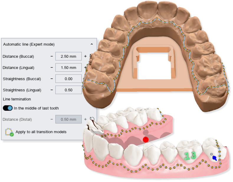 Deltaface, ArchForm, ONYXCEPH, 3Shape Ortho System, 3Shape Clear Aligner Studio, NemoCast, Nemotec, Ortho X Aligner, diorco, dentOne, 3dLeone, 3D Leone Designer, SureSmile Aligner, ulab, ulabsystems, blue sky bio, Maestro 3D, M3D, AGE Solutions, MDS500, Miglior software per ortodontia, Software per posizionamento Brackets, Modelli studio digitali, Prototipazione rapida per odontoiatria, 3D Scanner per gioielleria, Scanner Dentale, Miglior Scanner Dentale, Software ortodontico per allineatori trasparenti, Progettazione digitale di allineatori trasparenti, Software CAD/CAM ortodontico, Prototipazione rapida per ortodonzia, Guida per la produzione di allineatori, Soluzioni software per allineatori dentali, Creazione digitale di apparecchi ortodontici, Modellazione 3D per allineatori dentali, Stampa 3D diretta di allineatori trasparenti, Software per la correzione ortodontica, Tecnologia avanzata per allineatori, Software per la progettazione di espansori, Taglio automatico degli allineatori, Ortho Studio Software, Dental Studio Software, Bande ed Espansori Digitali, Bite-splint digitale, Paradenti digitale, Segmentazione automatica dei denti basata su Intelligenza Artificiale, Ortodonzia digitale basata su Intelligenza Artificiale, Software per il trattamento ortodontico, Software per allineatori dentali con intelligenza artificiale, Allineatori dentali digitali AI, Soluzioni software AI per allineatori dentali, Tecnologia AI per la correzione ortodontica Pianificazione ortodontica basata su intelligenza artificiale, Software per allineatori dentali basato su cloud, Soluzioni cloud per ortodonzia, Web viewer di casi ortodontici, Lingual Holding Appliance (LLHA), Trans-Palatal Arch (TPA)