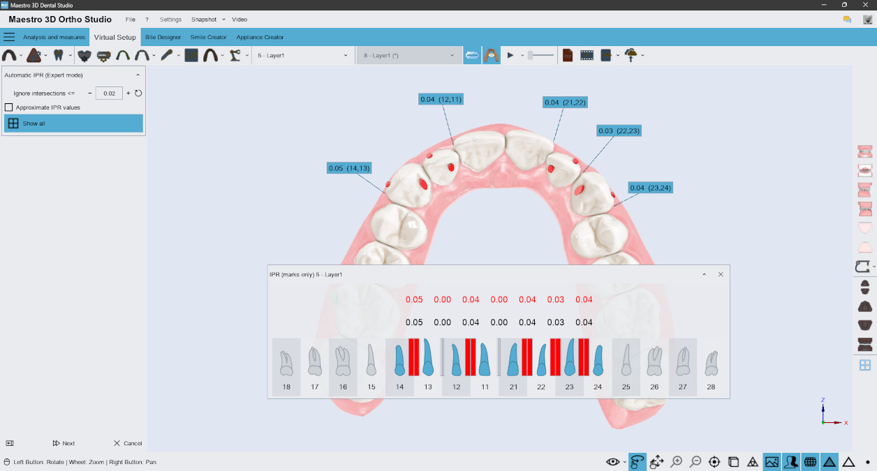 Deltaface, ArchForm, ONYXCEPH, 3Shape Ortho System, 3Shape Clear Aligner Studio, NemoCast, Nemotec, Ortho X Aligner, diorco, dentOne, 3dLeone, 3D Leone Designer, SureSmile Aligner, ulab, ulabsystems, blue sky bio, Maestro 3D, M3D, AGE Solutions, MDS500, Best orthodontic software, Bracket placement software, Digital study models, Rapid prototyping for dentistry, 3D scanner for jewelry, Dental scanner, Best dental scanner, Orthodontic software for clear aligners, Digital design of clear aligners, Orthodontic CAD/CAM software, Rapid prototyping for orthodontics, Guide for aligner production, Dental aligner software solutions, Digital creation of orthodontic appliances, 3D modeling for dental aligners, Direct 3D printing of clear aligners, Orthodontic correction software, Advanced technology for aligners, Software for expander design, Automatic aligner cutting, Ortho Studio Software, Dental Studio Software, Digital bands and expanders, Digital bite splint, Digital mouthguard, AI-based automatic tooth segmentation, AI-based digital orthodontics, Orthodontic treatment software, AI-powered dental aligner software, AI-driven digital dental aligners, AI software solutions for dental aligners, AI technology for orthodontic correction, AI-based orthodontic planning, Cloud-based dental aligner software, Cloud solutions for orthodontics, Web viewer for orthodontic cases, Lingual Holding Appliance (LLHA), Trans-Palatal Arch (TPA)