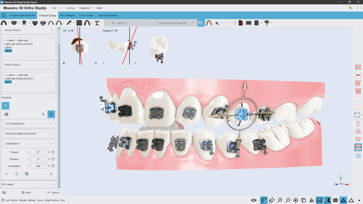 Maestro 3D Dental Studio | Ortho Studio | Smile Creator