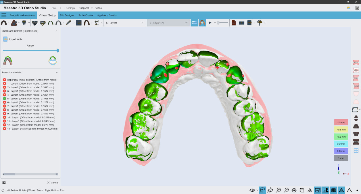 Deltaface, ArchForm, ONYXCEPH, 3Shape Ortho System, 3Shape Clear Aligner Studio, NemoCast, Nemotec, Ortho X Aligner, diorco, dentOne, 3dLeone, 3D Leone Designer, SureSmile Aligner, ulab, ulabsystems, blue sky bio, Maestro 3D, M3D, AGE Solutions, MDS500, Best orthodontic software, Bracket placement software, Digital study models, Rapid prototyping for dentistry, 3D scanner for jewelry, Dental scanner, Best dental scanner, Orthodontic software for clear aligners, Digital design of clear aligners, Orthodontic CAD/CAM software, Rapid prototyping for orthodontics, Guide for aligner production, Dental aligner software solutions, Digital creation of orthodontic appliances, 3D modeling for dental aligners, Direct 3D printing of clear aligners, Orthodontic correction software, Advanced technology for aligners, Software for expander design, Automatic aligner cutting, Ortho Studio Software, Dental Studio Software, Digital bands and expanders, Digital bite splint, Digital mouthguard, AI-based automatic tooth segmentation, AI-based digital orthodontics, Orthodontic treatment software, AI-powered dental aligner software, AI-driven digital dental aligners, AI software solutions for dental aligners, AI technology for orthodontic correction, AI-based orthodontic planning, Cloud-based dental aligner software, Cloud solutions for orthodontics, Web viewer for orthodontic cases, Lingual Holding Appliance (LLHA), Trans-Palatal Arch (TPA)