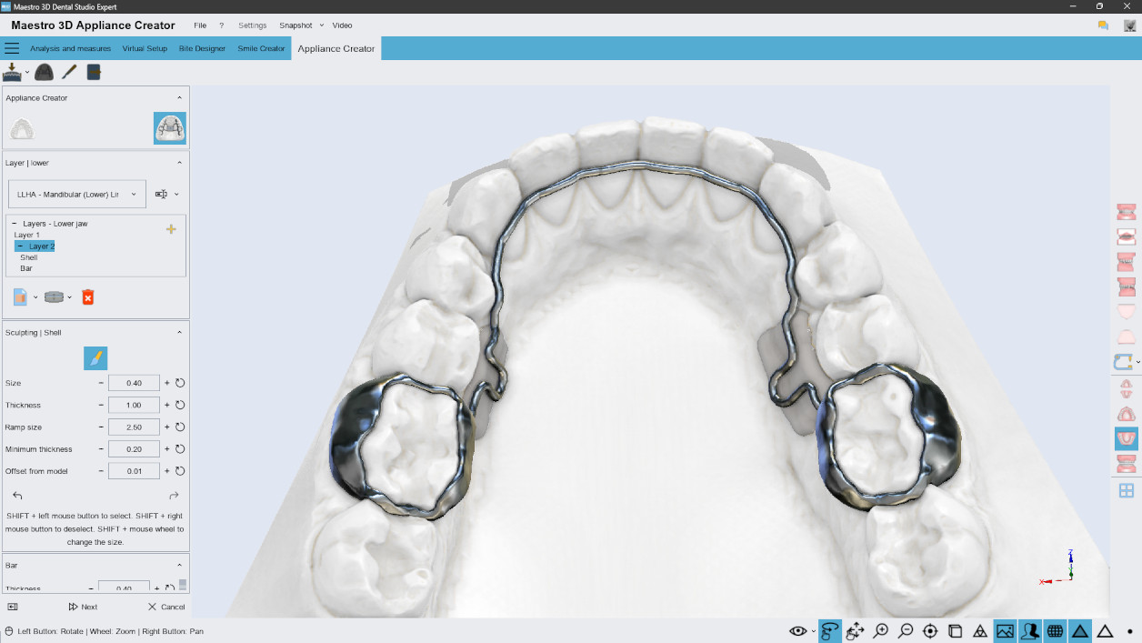 Deltaface, ArchForm, ONYXCEPH, 3Shape Ortho System, 3Shape Clear Aligner Studio, NemoCast, Nemotec, Ortho X Aligner, diorco, dentOne, 3dLeone, 3D Leone Designer, SureSmile Aligner, ulab, ulabsystems, blue sky bio, Maestro 3D, M3D, AGE Solutions, MDS500, Best orthodontic software, Bracket placement software, Digital study models, Rapid prototyping for dentistry, 3D scanner for jewelry, Dental scanner, Best dental scanner, Orthodontic software for clear aligners, Digital design of clear aligners, Orthodontic CAD/CAM software, Rapid prototyping for orthodontics, Guide for aligner production, Dental aligner software solutions, Digital creation of orthodontic appliances, 3D modeling for dental aligners, Direct 3D printing of clear aligners, Orthodontic correction software, Advanced technology for aligners, Software for expander design, Automatic aligner cutting, Ortho Studio Software, Dental Studio Software, Digital bands and expanders, Digital bite splint, Digital mouthguard, AI-based automatic tooth segmentation, AI-based digital orthodontics, Orthodontic treatment software, AI-powered dental aligner software, AI-driven digital dental aligners, AI software solutions for dental aligners, AI technology for orthodontic correction, AI-based orthodontic planning, Cloud-based dental aligner software, Cloud solutions for orthodontics, Web viewer for orthodontic cases, Lingual Holding Appliance (LLHA), Trans-Palatal Arch (TPA)