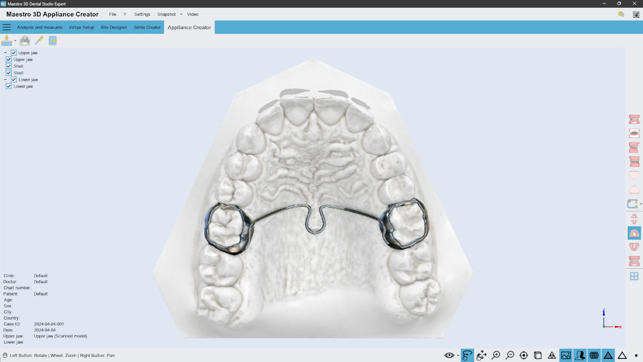 Deltaface, ArchForm, ONYXCEPH, 3Shape Ortho System, 3Shape Clear Aligner Studio, NemoCast, Nemotec, Ortho X Aligner, diorco, dentOne, 3dLeone, 3D Leone Designer, SureSmile Aligner, ulab, ulabsystems, blue sky bio, Maestro 3D, M3D, AGE Solutions, MDS500, Best orthodontic software, Bracket placement software, Digital study models, Rapid prototyping for dentistry, 3D scanner for jewelry, Dental scanner, Best dental scanner, Orthodontic software for clear aligners, Digital design of clear aligners, Orthodontic CAD/CAM software, Rapid prototyping for orthodontics, Guide for aligner production, Dental aligner software solutions, Digital creation of orthodontic appliances, 3D modeling for dental aligners, Direct 3D printing of clear aligners, Orthodontic correction software, Advanced technology for aligners, Software for expander design, Automatic aligner cutting, Ortho Studio Software, Dental Studio Software, Digital bands and expanders, Digital bite splint, Digital mouthguard, AI-based automatic tooth segmentation, AI-based digital orthodontics, Orthodontic treatment software, AI-powered dental aligner software, AI-driven digital dental aligners, AI software solutions for dental aligners, AI technology for orthodontic correction, AI-based orthodontic planning, Cloud-based dental aligner software, Cloud solutions for orthodontics, Web viewer for orthodontic cases, Lingual Holding Appliance (LLHA), Trans-Palatal Arch (TPA)