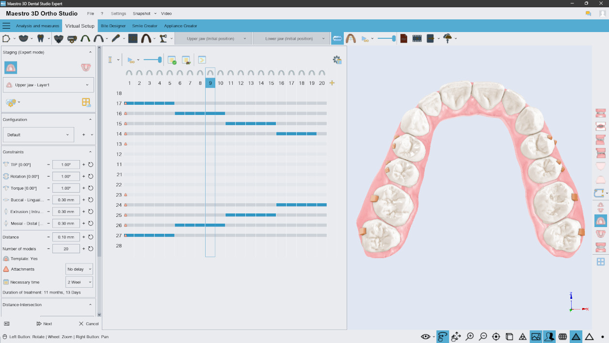 Deltaface, ArchForm, ONYXCEPH, 3Shape Ortho System, 3Shape Clear Aligner Studio, NemoCast, Nemotec, Ortho X Aligner, diorco, dentOne, 3dLeone, 3D Leone Designer, SureSmile Aligner, ulab, ulabsystems, blue sky bio, Maestro 3D, M3D, AGE Solutions, MDS500, Best orthodontic software, Bracket placement software, Digital study models, Rapid prototyping for dentistry, 3D scanner for jewelry, Dental scanner, Best dental scanner, Orthodontic software for clear aligners, Digital design of clear aligners, Orthodontic CAD/CAM software, Rapid prototyping for orthodontics, Guide for aligner production, Dental aligner software solutions, Digital creation of orthodontic appliances, 3D modeling for dental aligners, Direct 3D printing of clear aligners, Orthodontic correction software, Advanced technology for aligners, Software for expander design, Automatic aligner cutting, Ortho Studio Software, Dental Studio Software, Digital bands and expanders, Digital bite splint, Digital mouthguard, AI-based automatic tooth segmentation, AI-based digital orthodontics, Orthodontic treatment software, AI-powered dental aligner software, AI-driven digital dental aligners, AI software solutions for dental aligners, AI technology for orthodontic correction, AI-based orthodontic planning, Cloud-based dental aligner software, Cloud solutions for orthodontics, Web viewer for orthodontic cases