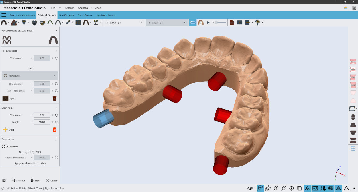 Deltaface, ArchForm, ONYXCEPH, 3Shape Ortho System, 3Shape Clear Aligner Studio, NemoCast, Nemotec, Ortho X Aligner, diorco, dentOne, 3dLeone, 3D Leone Designer, SureSmile Aligner, ulab, ulabsystems, blue sky bio, Maestro 3D, M3D, AGE Solutions, MDS500, Best orthodontic software, Bracket placement software, Digital study models, Rapid prototyping for dentistry, 3D scanner for jewelry, Dental scanner, Best dental scanner, Orthodontic software for clear aligners, Digital design of clear aligners, Orthodontic CAD/CAM software, Rapid prototyping for orthodontics, Guide for aligner production, Dental aligner software solutions, Digital creation of orthodontic appliances, 3D modeling for dental aligners, Direct 3D printing of clear aligners, Orthodontic correction software, Advanced technology for aligners, Software for expander design, Automatic aligner cutting, Ortho Studio Software, Dental Studio Software, Digital bands and expanders, Digital bite splint, Digital mouthguard, AI-based automatic tooth segmentation, AI-based digital orthodontics, Orthodontic treatment software, AI-powered dental aligner software, AI-driven digital dental aligners, AI software solutions for dental aligners, AI technology for orthodontic correction, AI-based orthodontic planning, Cloud-based dental aligner software, Cloud solutions for orthodontics, Web viewer for orthodontic cases, Lingual Holding Appliance (LLHA), Trans-Palatal Arch (TPA)