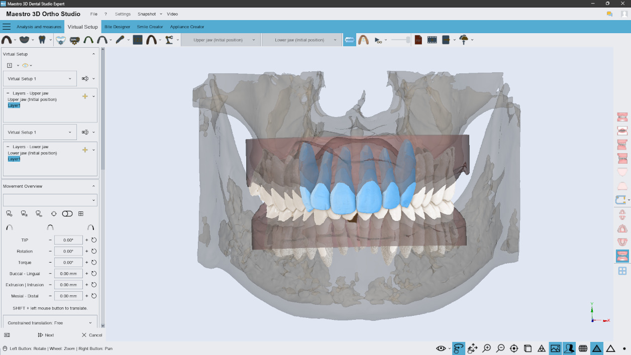 Deltaface, ArchForm, ONYXCEPH, 3Shape Ortho System, 3Shape Clear Aligner Studio, NemoCast, Nemotec, Ortho X Aligner, diorco, dentOne, 3dLeone, 3D Leone Designer, SureSmile Aligner, ulab, ulabsystems, blue sky bio, Maestro 3D, M3D, AGE Solutions, MDS500, Best orthodontic software, Bracket placement software, Digital study models, Rapid prototyping for dentistry, 3D scanner for jewelry, Dental scanner, Best dental scanner, Orthodontic software for clear aligners, Digital design of clear aligners, Orthodontic CAD/CAM software, Rapid prototyping for orthodontics, Guide for aligner production, Dental aligner software solutions, Digital creation of orthodontic appliances, 3D modeling for dental aligners, Direct 3D printing of clear aligners, Orthodontic correction software, Advanced technology for aligners, Software for expander design, Automatic aligner cutting, Ortho Studio Software, Dental Studio Software, Digital bands and expanders, Digital bite splint, Digital mouthguard, AI-based automatic tooth segmentation, AI-based digital orthodontics, Orthodontic treatment software, AI-powered dental aligner software, AI-driven digital dental aligners, AI software solutions for dental aligners, AI technology for orthodontic correction, AI-based orthodontic planning, Cloud-based dental aligner software, Cloud solutions for orthodontics, Web viewer for orthodontic cases