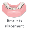 maestro3d dental studio indirect bonding