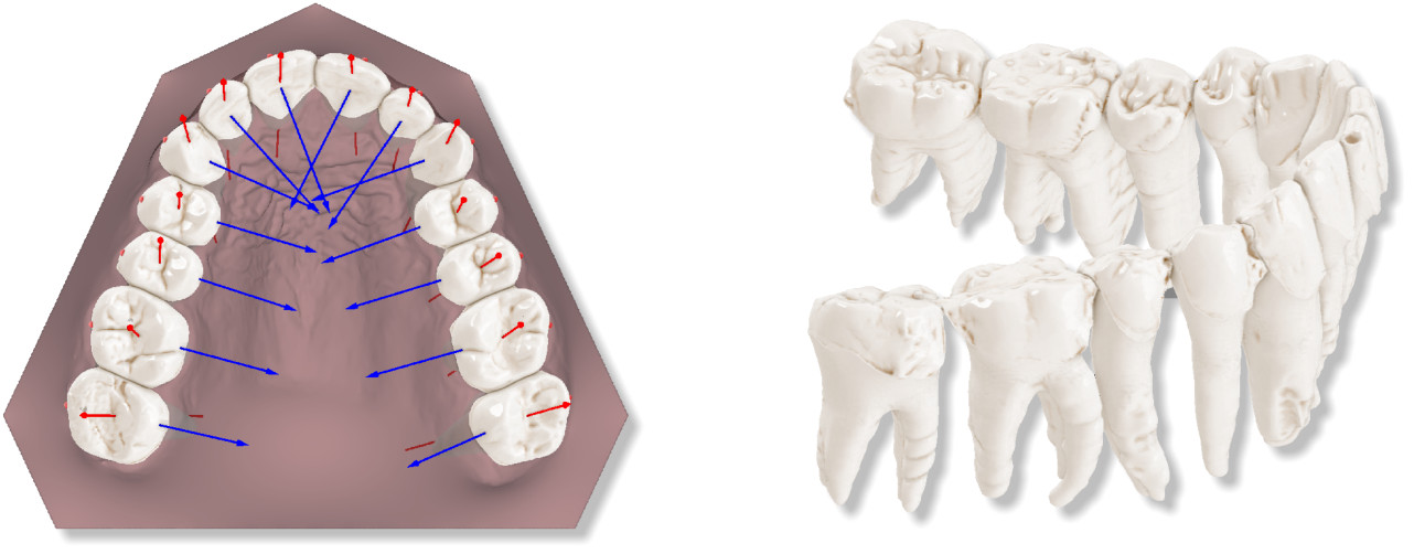 Deltaface, ArchForm, ONYXCEPH, 3Shape Ortho System, 3Shape Clear Aligner Studio, NemoCast, Nemotec, Ortho X Aligner, diorco, dentOne, 3dLeone, 3D Leone Designer, SureSmile Aligner, ulab, ulabsystems, blue sky bio, Maestro 3D, M3D, AGE Solutions, MDS500, Best orthodontic software, Bracket placement software, Digital study models, Rapid prototyping for dentistry, 3D scanner for jewelry, Dental scanner, Best dental scanner, Orthodontic software for clear aligners, Digital design of clear aligners, Orthodontic CAD/CAM software, Rapid prototyping for orthodontics, Guide for aligner production, Dental aligner software solutions, Digital creation of orthodontic appliances, 3D modeling for dental aligners, Direct 3D printing of clear aligners, Orthodontic correction software, Advanced technology for aligners, Software for expander design, Automatic aligner cutting, Ortho Studio Software, Dental Studio Software, Digital bands and expanders, Digital bite splint, Digital mouthguard, AI-based automatic tooth segmentation, AI-based digital orthodontics, Orthodontic treatment software, AI-powered dental aligner software, AI-driven digital dental aligners, AI software solutions for dental aligners, AI technology for orthodontic correction, AI-based orthodontic planning, Cloud-based dental aligner software, Cloud solutions for orthodontics, Web viewer for orthodontic cases