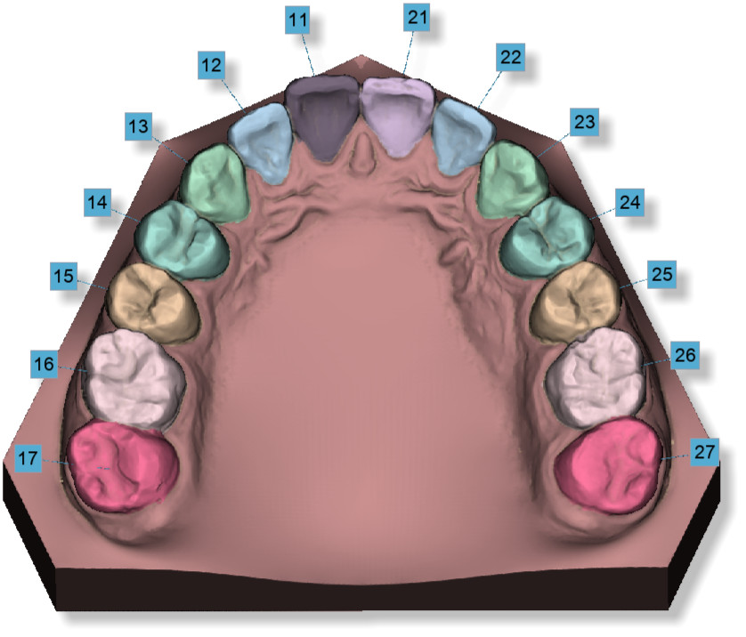 Deltaface, ArchForm, ONYXCEPH, 3Shape Ortho System, 3Shape Clear Aligner Studio, NemoCast, Nemotec, Ortho X Aligner, diorco, dentOne, 3dLeone, 3D Leone Designer, SureSmile Aligner, ulab, ulabsystems, blue sky bio, Maestro 3D, M3D, AGE Solutions, MDS500, Best orthodontic software, Bracket placement software, Digital study models, Rapid prototyping for dentistry, 3D scanner for jewelry, Dental scanner, Best dental scanner, Orthodontic software for clear aligners, Digital design of clear aligners, Orthodontic CAD/CAM software, Rapid prototyping for orthodontics, Guide for aligner production, Dental aligner software solutions, Digital creation of orthodontic appliances, 3D modeling for dental aligners, Direct 3D printing of clear aligners, Orthodontic correction software, Advanced technology for aligners, Software for expander design, Automatic aligner cutting, Ortho Studio Software, Dental Studio Software, Digital bands and expanders, Digital bite splint, Digital mouthguard, AI-based automatic tooth segmentation, AI-based digital orthodontics, Orthodontic treatment software, AI-powered dental aligner software, AI-driven digital dental aligners, AI software solutions for dental aligners, AI technology for orthodontic correction, AI-based orthodontic planning, Cloud-based dental aligner software, Cloud solutions for orthodontics, Web viewer for orthodontic cases, Lingual Holding Appliance (LLHA), Trans-Palatal Arch (TPA)