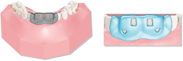 Deltaface, ArchForm, ONYXCEPH, 3Shape Ortho System, 3Shape Clear Aligner Studio, NemoCast, Nemotec, Ortho X Aligner, diorco, dentOne, 3dLeone, 3D Leone Designer, SureSmile Aligner, ulab, ulabsystems, blue sky bio, Maestro 3D, M3D, AGE Solutions, MDS500, Best orthodontic software, Bracket placement software, Digital study models, Rapid prototyping for dentistry, 3D scanner for jewelry, Dental scanner, Best dental scanner, Orthodontic software for clear aligners, Digital design of clear aligners, Orthodontic CAD/CAM software, Rapid prototyping for orthodontics, Guide for aligner production, Dental aligner software solutions, Digital creation of orthodontic appliances, 3D modeling for dental aligners, Direct 3D printing of clear aligners, Orthodontic correction software, Advanced technology for aligners, Software for expander design, Automatic aligner cutting, Ortho Studio Software, Dental Studio Software, Digital bands and expanders, Digital bite splint, Digital mouthguard, AI-based automatic tooth segmentation, AI-based digital orthodontics, Orthodontic treatment software, AI-powered dental aligner software, AI-driven digital dental aligners, AI software solutions for dental aligners, AI technology for orthodontic correction, AI-based orthodontic planning, Cloud-based dental aligner software, Cloud solutions for orthodontics, Web viewer for orthodontic cases