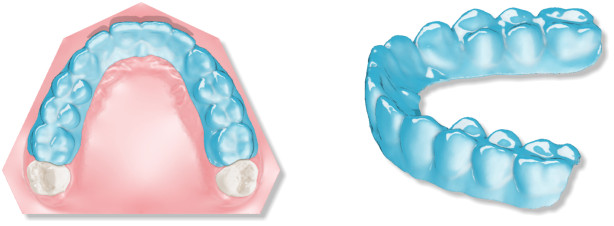 Deltaface, ArchForm, ONYXCEPH, 3Shape Ortho System, 3Shape Clear Aligner Studio, NemoCast, Nemotec, Ortho X Aligner, diorco, dentOne, 3dLeone, 3D Leone Designer, SureSmile Aligner, ulab, ulabsystems, blue sky bio, Maestro 3D, M3D, AGE Solutions, MDS500, Best orthodontic software, Bracket placement software, Digital study models, Rapid prototyping for dentistry, 3D scanner for jewelry, Dental scanner, Best dental scanner, Orthodontic software for clear aligners, Digital design of clear aligners, Orthodontic CAD/CAM software, Rapid prototyping for orthodontics, Guide for aligner production, Dental aligner software solutions, Digital creation of orthodontic appliances, 3D modeling for dental aligners, Direct 3D printing of clear aligners, Orthodontic correction software, Advanced technology for aligners, Software for expander design, Automatic aligner cutting, Ortho Studio Software, Dental Studio Software, Digital bands and expanders, Digital bite splint, Digital mouthguard, AI-based automatic tooth segmentation, AI-based digital orthodontics, Orthodontic treatment software, AI-powered dental aligner software, AI-driven digital dental aligners, AI software solutions for dental aligners, AI technology for orthodontic correction, AI-based orthodontic planning, Cloud-based dental aligner software, Cloud solutions for orthodontics, Web viewer for orthodontic cases, Lingual Holding Appliance (LLHA), Trans-Palatal Arch (TPA)