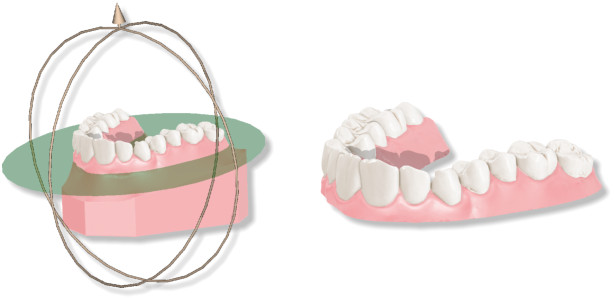 Deltaface, ArchForm, ONYXCEPH, 3Shape Ortho System, 3Shape Clear Aligner Studio, NemoCast, Nemotec, Ortho X Aligner, diorco, dentOne, 3dLeone, 3D Leone Designer, SureSmile Aligner, ulab, ulabsystems, blue sky bio, Maestro 3D, M3D, AGE Solutions, MDS500, Best orthodontic software, Bracket placement software, Digital study models, Rapid prototyping for dentistry, 3D scanner for jewelry, Dental scanner, Best dental scanner, Orthodontic software for clear aligners, Digital design of clear aligners, Orthodontic CAD/CAM software, Rapid prototyping for orthodontics, Guide for aligner production, Dental aligner software solutions, Digital creation of orthodontic appliances, 3D modeling for dental aligners, Direct 3D printing of clear aligners, Orthodontic correction software, Advanced technology for aligners, Software for expander design, Automatic aligner cutting, Ortho Studio Software, Dental Studio Software, Digital bands and expanders, Digital bite splint, Digital mouthguard, AI-based automatic tooth segmentation, AI-based digital orthodontics, Orthodontic treatment software, AI-powered dental aligner software, AI-driven digital dental aligners, AI software solutions for dental aligners, AI technology for orthodontic correction, AI-based orthodontic planning, Cloud-based dental aligner software, Cloud solutions for orthodontics, Web viewer for orthodontic cases