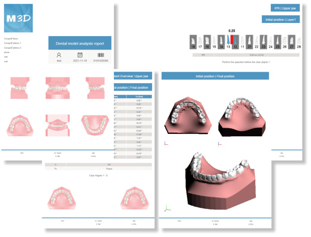 Deltaface, ArchForm, ONYXCEPH, 3Shape Ortho System, 3Shape Clear Aligner Studio, NemoCast, Nemotec, Ortho X Aligner, diorco, dentOne, 3dLeone, 3D Leone Designer, SureSmile Aligner, ulab, ulabsystems, blue sky bio, Maestro 3D, M3D, AGE Solutions, MDS500, Best orthodontic software, Bracket placement software, Digital study models, Rapid prototyping for dentistry, 3D scanner for jewelry, Dental scanner, Best dental scanner, Orthodontic software for clear aligners, Digital design of clear aligners, Orthodontic CAD/CAM software, Rapid prototyping for orthodontics, Guide for aligner production, Dental aligner software solutions, Digital creation of orthodontic appliances, 3D modeling for dental aligners, Direct 3D printing of clear aligners, Orthodontic correction software, Advanced technology for aligners, Software for expander design, Automatic aligner cutting, Ortho Studio Software, Dental Studio Software, Digital bands and expanders, Digital bite splint, Digital mouthguard, AI-based automatic tooth segmentation, AI-based digital orthodontics, Orthodontic treatment software, AI-powered dental aligner software, AI-driven digital dental aligners, AI software solutions for dental aligners, AI technology for orthodontic correction, AI-based orthodontic planning, Cloud-based dental aligner software, Cloud solutions for orthodontics, Web viewer for orthodontic cases, Lingual Holding Appliance (LLHA), Trans-Palatal Arch (TPA)