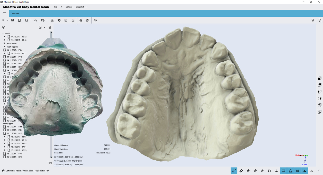 Deltaface, ArchForm, ONYXCEPH, 3Shape Ortho System, 3Shape Clear Aligner Studio, NemoCast, Nemotec, Ortho X Aligner, diorco, dentOne, 3dLeone, 3D Leone Designer, SureSmile Aligner, ulab, ulabsystems, blue sky bio, Maestro 3D, M3D, AGE Solutions, MDS500, Melhor software ortodôntico, Software de colocação de braquetes, Modelos digitais de estudo, Prototipagem rápida para odontologia, Scanner 3D para joalheria, Scanner dental, Melhor scanner dental, Software ortodôntico para alinhadores transparentes, Design digital de alinhadores transparentes, Software CAD/CAM ortodôntico, Prototipagem rápida para ortodontia, Guia para produção de alinhadores, Soluções de software para alinhadores dentais, Criação digital de aparelhos ortodônticos, Modelagem 3D para alinhadores dentais, Impressão 3D direta de alinhadores transparentes, Software de correção ortodôntica, Tecnologia avançada para alinhadores, Software para design de expansores, Corte automático de alinhadores, Software Ortho Studio, Software Dental Studio, Bandas digitais e expansores, Splint digital, Protetor bucal digital, Segmentação automática de dentes com base em inteligência artificial, Ortodontia digital baseada em inteligência artificial, Software de tratamento ortodôntico, Software de alinhadores dentais com inteligência artificial, Alinhadores dentais digitais com IA, Soluções de software de IA para alinhadores dentais, Tecnologia de IA para correção ortodôntica, Planificação ortodôntica baseada em inteligência artificial, Software de alinhadores dentais baseado na nuvem, Soluções na nuvem para ortodontia, Visor web para casos de ortodontia, Lingual Holding Appliance (LLHA), Trans-Palatal Arch (TPA)