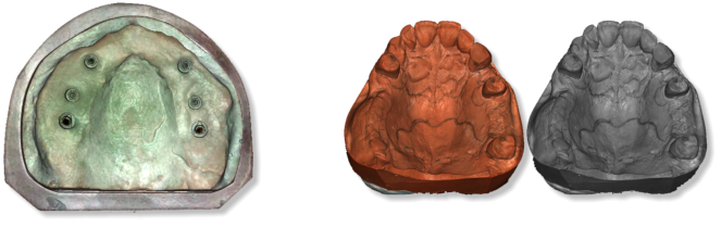 Deltaface, ArchForm, ONYXCEPH, 3Shape Ortho System, 3Shape Clear Aligner Studio, NemoCast, Nemotec, Ortho X Aligner, diorco, dentOne, 3dLeone, 3D Leone Designer, SureSmile Aligner, ulab, ulabsystems, blue sky bio, Maestro 3D, M3D, AGE Solutions, MDS500, Best orthodontic software, Bracket placement software, Digital study models, Rapid prototyping for dentistry, 3D scanner for jewelry, Dental scanner, Best dental scanner, Orthodontic software for clear aligners, Digital design of clear aligners, Orthodontic CAD/CAM software, Rapid prototyping for orthodontics, Guide for aligner production, Dental aligner software solutions, Digital creation of orthodontic appliances, 3D modeling for dental aligners, Direct 3D printing of clear aligners, Orthodontic correction software, Advanced technology for aligners, Software for expander design, Automatic aligner cutting, Ortho Studio Software, Dental Studio Software, Digital bands and expanders, Digital bite splint, Digital mouthguard, AI-based automatic tooth segmentation, AI-based digital orthodontics, Orthodontic treatment software, AI-powered dental aligner software, AI-driven digital dental aligners, AI software solutions for dental aligners, AI technology for orthodontic correction, AI-based orthodontic planning, Cloud-based dental aligner software, Cloud solutions for orthodontics, Web viewer for orthodontic cases, Lingual Holding Appliance (LLHA), Trans-Palatal Arch (TPA)