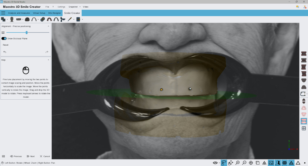 Deltaface, ArchForm, ONYXCEPH, 3Shape Ortho System, 3Shape Clear Aligner Studio, NemoCast, Nemotec, Ortho X Aligner, diorco, dentOne, 3dLeone, 3D Leone Designer, SureSmile Aligner, ulab, ulabsystems, blue sky bio, Maestro 3D, M3D, AGE Solutions, MDS500, Meilleur logiciel orthodontique, Logiciel de placement de brackets, Modèles d'étude numériques, Prototypage rapide pour la dentisterie, Scanner 3D pour la joaillerie, Scanner dentaire, Meilleur scanner dentaire, Logiciel orthodontique pour les aligneurs transparents, Conception numérique d'aligneurs transparents, Logiciel CAD/CAM orthodontique, Prototypage rapide pour l'orthodontie, Guide de production d'aligneurs, Solutions logicielles pour les aligneurs dentaires, Création numérique d'appareils orthodontiques, Modélisation 3D pour les aligneurs dentaires, Impression 3D directe d'aligneurs transparents, Logiciel de correction orthodontique, Technologie avancée pour les aligneurs, Logiciel de conception d'expandeurs, Découpe automatique des aligneurs, Logiciel Ortho Studio, Logiciel Dental Studio, Bandes numériques et expandeurs, Gouttière dentaire numérique, Protège-dents numérique, Segmentation automatique des dents basée sur l'intelligence artificielle, Orthodontie numérique basée sur l'intelligence artificielle, Logiciel de traitement orthodontique, Logiciel d'aligneurs dentaires basé sur l'intelligence artificielle, Aligneurs dentaires numériques basés sur l'IA, Solutions logicielles d'IA pour les aligneurs dentaires, Technologie d'IA pour la correction orthodontique, Planification orthodontique basée sur l'intelligence artificielle, Logiciel d'aligneurs dentaires basé sur le cloud, Solutions cloud pour l'orthodontie, Visionneuse web pour les cas orthodontiques, Lingual Holding Appliance (LLHA), Trans-Palatal Arch (TPA)