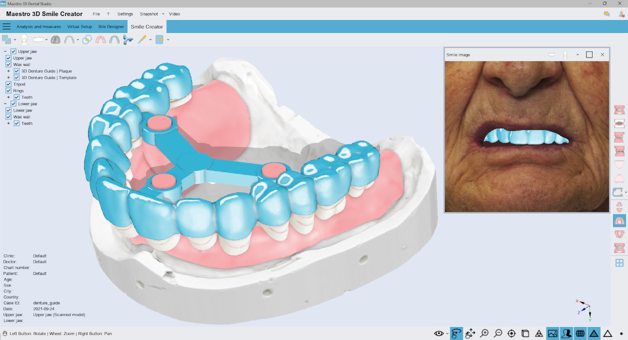 Deltaface, ArchForm, ONYXCEPH, 3Shape Ortho System, 3Shape Clear Aligner Studio, NemoCast, Nemotec, Ortho X Aligner, diorco, dentOne, 3dLeone, 3D Leone Designer, SureSmile Aligner, ulab, ulabsystems, blue sky bio, Maestro 3D, M3D, AGE Solutions, MDS500, Best orthodontic software, Bracket placement software, Digital study models, Rapid prototyping for dentistry, 3D scanner for jewelry, Dental scanner, Best dental scanner, Orthodontic software for clear aligners, Digital design of clear aligners, Orthodontic CAD/CAM software, Rapid prototyping for orthodontics, Guide for aligner production, Dental aligner software solutions, Digital creation of orthodontic appliances, 3D modeling for dental aligners, Direct 3D printing of clear aligners, Orthodontic correction software, Advanced technology for aligners, Software for expander design, Automatic aligner cutting, Ortho Studio Software, Dental Studio Software, Digital bands and expanders, Digital bite splint, Digital mouthguard, AI-based automatic tooth segmentation, AI-based digital orthodontics, Orthodontic treatment software, AI-powered dental aligner software, AI-driven digital dental aligners, AI software solutions for dental aligners, AI technology for orthodontic correction, AI-based orthodontic planning, Cloud-based dental aligner software, Cloud solutions for orthodontics, Web viewer for orthodontic cases, Lingual Holding Appliance (LLHA), Trans-Palatal Arch (TPA)