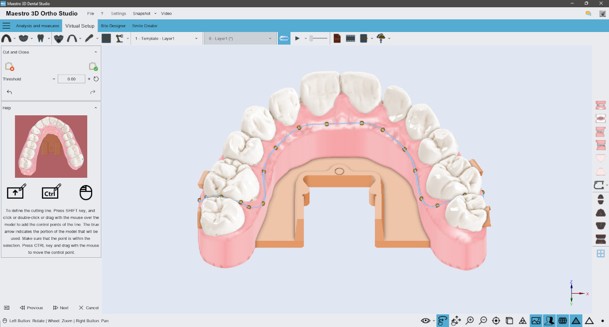 Maestro 3D Dental Studio | Ortho Studio | Smile Creator | Appliance Creator