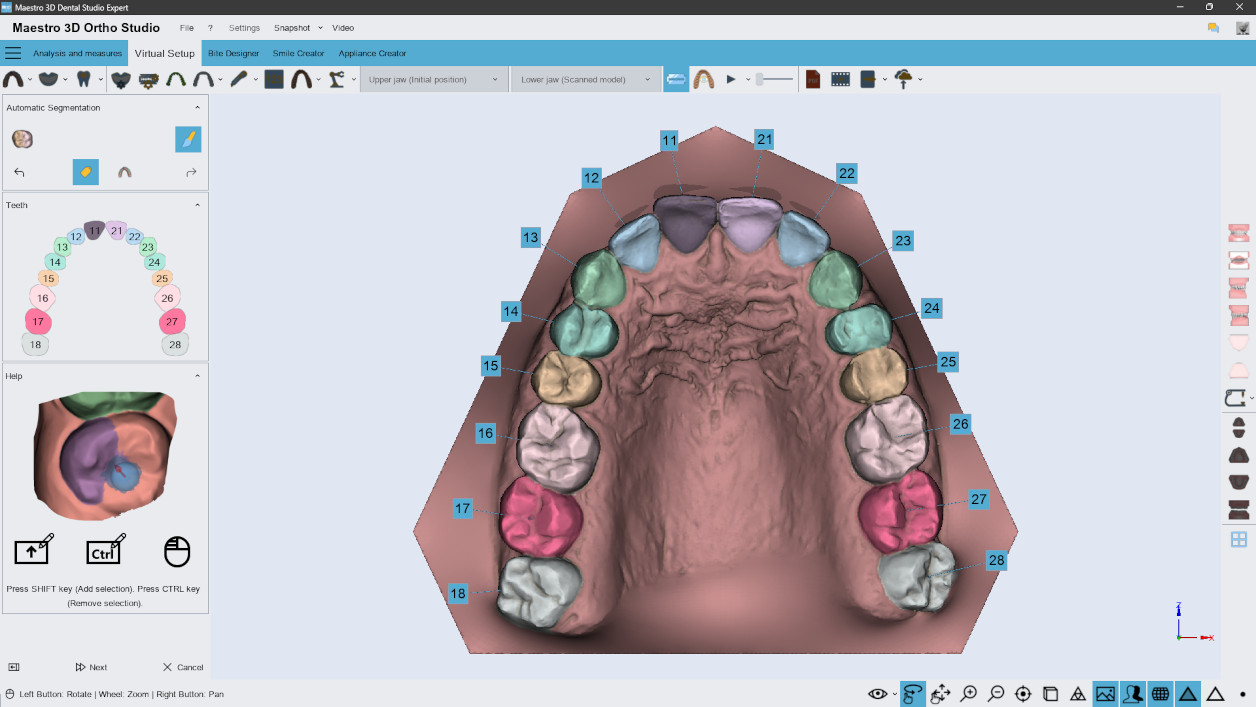 Maestro 3D Dental Studio | Ortho Studio | Smile Creator