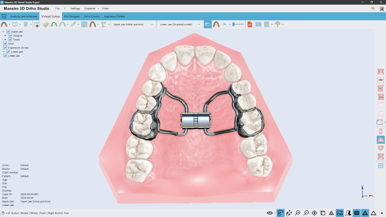 Deltaface, ArchForm, ONYXCEPH, 3Shape Ortho System, 3Shape Clear Aligner Studio, NemoCast, Nemotec, Ortho X Aligner, diorco, dentOne, 3dLeone, 3D Leone Designer, SureSmile Aligner, ulab, ulabsystems, blue sky bio, Maestro 3D, M3D, AGE Solutions, MDS500, Best orthodontic software, Bracket placement software, Digital study models, Rapid prototyping for dentistry, 3D scanner for jewelry, Dental scanner, Best dental scanner, Orthodontic software for clear aligners, Digital design of clear aligners, Orthodontic CAD/CAM software, Rapid prototyping for orthodontics, Guide for aligner production, Dental aligner software solutions, Digital creation of orthodontic appliances, 3D modeling for dental aligners, Direct 3D printing of clear aligners, Orthodontic correction software, Advanced technology for aligners, Software for expander design, Automatic aligner cutting, Ortho Studio Software, Dental Studio Software, Digital bands and expanders, Digital bite splint, Digital mouthguard, AI-based automatic tooth segmentation, AI-based digital orthodontics, Orthodontic treatment software, AI-powered dental aligner software, AI-driven digital dental aligners, AI software solutions for dental aligners, AI technology for orthodontic correction, AI-based orthodontic planning, Cloud-based dental aligner software, Cloud solutions for orthodontics, Web viewer for orthodontic cases, Lingual Holding Appliance (LLHA), Trans-Palatal Arch (TPA)