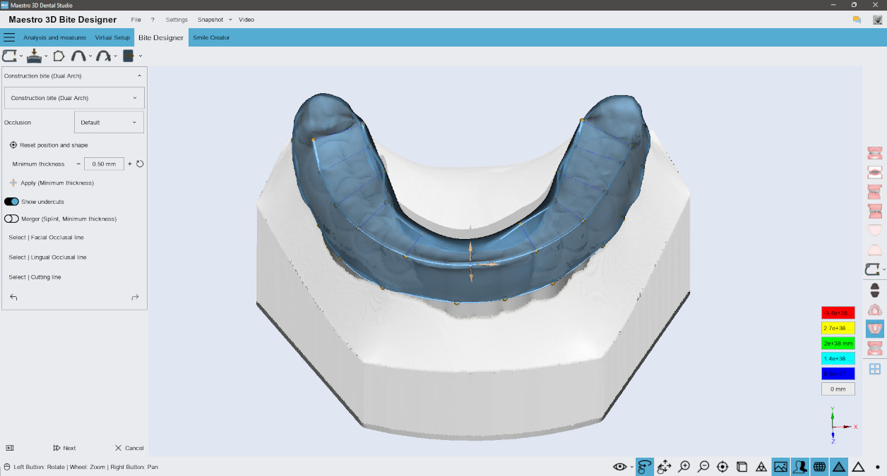 Deltaface, ArchForm, ONYXCEPH, 3Shape Ortho System, 3Shape Clear Aligner Studio, NemoCast, Nemotec, Ortho X Aligner, diorco, dentOne, 3dLeone, 3D Leone Designer, SureSmile Aligner, ulab, ulabsystems, blue sky bio, Maestro 3D, M3D, AGE Solutions, MDS500, Best orthodontic software, Bracket placement software, Digital study models, Rapid prototyping for dentistry, 3D scanner for jewelry, Dental scanner, Best dental scanner, Orthodontic software for clear aligners, Digital design of clear aligners, Orthodontic CAD/CAM software, Rapid prototyping for orthodontics, Guide for aligner production, Dental aligner software solutions, Digital creation of orthodontic appliances, 3D modeling for dental aligners, Direct 3D printing of clear aligners, Orthodontic correction software, Advanced technology for aligners, Software for expander design, Automatic aligner cutting, Ortho Studio Software, Dental Studio Software, Digital bands and expanders, Digital bite splint, Digital mouthguard, AI-based automatic tooth segmentation, AI-based digital orthodontics, Orthodontic treatment software, AI-powered dental aligner software, AI-driven digital dental aligners, AI software solutions for dental aligners, AI technology for orthodontic correction, AI-based orthodontic planning, Cloud-based dental aligner software, Cloud solutions for orthodontics, Web viewer for orthodontic cases