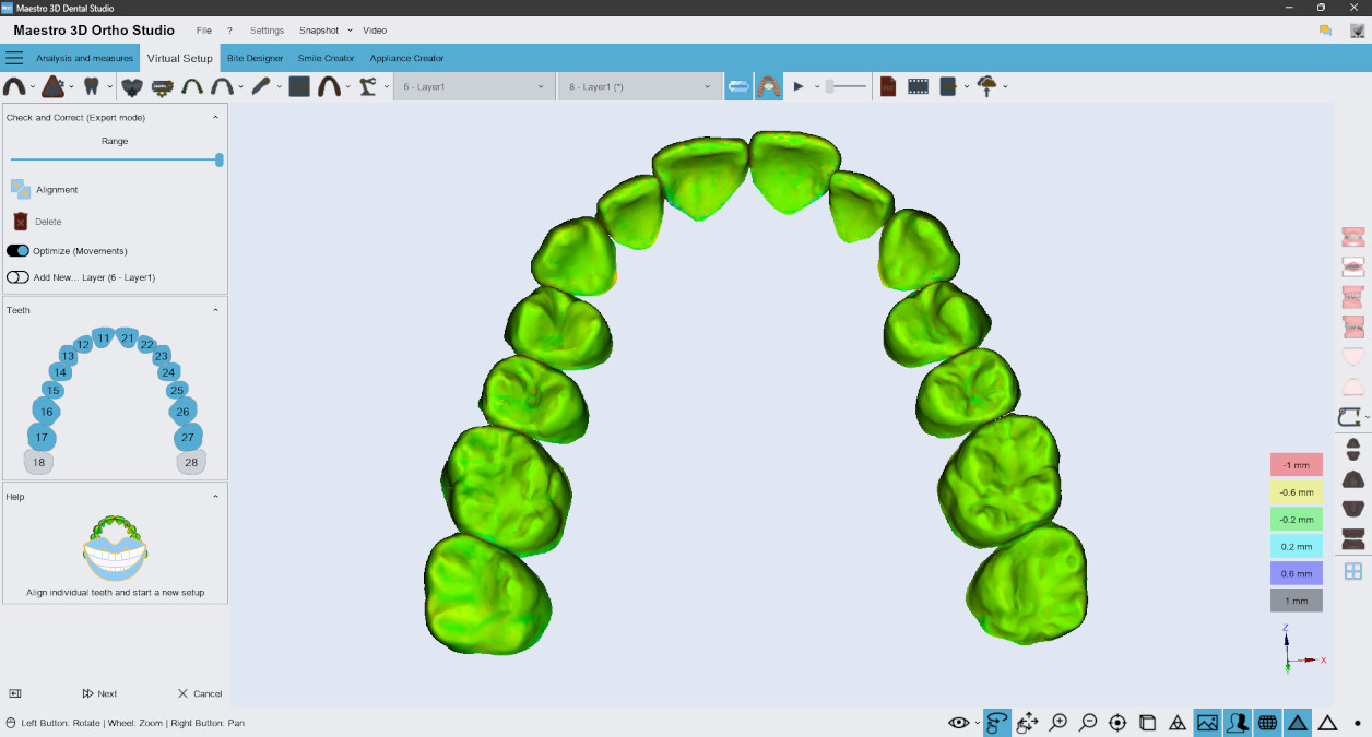 Deltaface, ArchForm, ONYXCEPH, 3Shape Ortho System, 3Shape Clear Aligner Studio, NemoCast, Nemotec, Ortho X Aligner, diorco, dentOne, 3dLeone, 3D Leone Designer, SureSmile Aligner, ulab, ulabsystems, blue sky bio, Maestro 3D, M3D, AGE Solutions, MDS500, Miglior software per ortodontia, Software per posizionamento Brackets, Modelli studio digitali, Prototipazione rapida per odontoiatria, 3D Scanner per gioielleria, Scanner Dentale, Miglior Scanner Dentale, Software ortodontico per allineatori trasparenti, Progettazione digitale di allineatori trasparenti, Software CAD/CAM ortodontico, Prototipazione rapida per ortodonzia, Guida per la produzione di allineatori, Soluzioni software per allineatori dentali, Creazione digitale di apparecchi ortodontici, Modellazione 3D per allineatori dentali, Stampa 3D diretta di allineatori trasparenti, Software per la correzione ortodontica, Tecnologia avanzata per allineatori, Software per la progettazione di espansori, Taglio automatico degli allineatori, Ortho Studio Software, Dental Studio Software, Bande ed Espansori Digitali, Bite-splint digitale, Paradenti digitale, Segmentazione automatica dei denti basata su Intelligenza Artificiale, Ortodonzia digitale basata su Intelligenza Artificiale, Software per il trattamento ortodontico, Software per allineatori dentali con intelligenza artificiale, Allineatori dentali digitali AI, Soluzioni software AI per allineatori dentali, Tecnologia AI per la correzione ortodontica Pianificazione ortodontica basata su intelligenza artificiale, Software per allineatori dentali basato su cloud, Soluzioni cloud per ortodonzia, Web viewer di casi ortodontici, Lingual Holding Appliance (LLHA), Trans-Palatal Arch (TPA)
