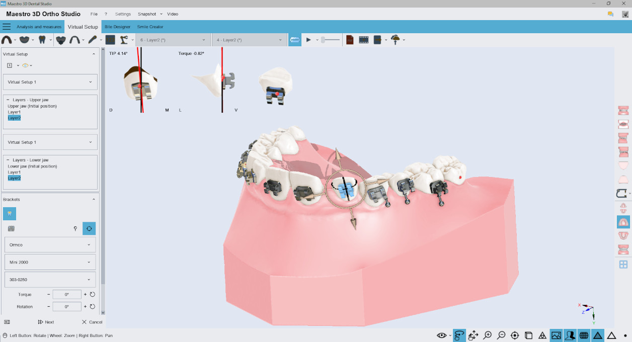 Deltaface, ArchForm, ONYXCEPH, 3Shape Ortho System, 3Shape Clear Aligner Studio, NemoCast, Nemotec, Ortho X Aligner, diorco, dentOne, 3dLeone, 3D Leone Designer, SureSmile Aligner, ulab, ulabsystems, blue sky bio, Maestro 3D, M3D, AGE Solutions, MDS500, Mejor software de ortodoncia, Software de colocación de brackets, Modelos digitales de estudio, Prototipado rápido para odontología, Escáner 3D para joyería, Escáner dental, Mejor escáner dental, Software ortodóntico para alineadores transparentes, Diseño digital de alineadores transparentes, Software CAD/CAM ortodóntico, Prototipado rápido para ortodoncia, Guía para la producción de alineadores, Soluciones de software para alineadores dentales, Creación digital de aparatos ortodónticos, Modelado 3D para alineadores dentales, Impresión 3D directa de alineadores transparentes, Software de corrección ortodóntica, Tecnología avanzada para alineadores, Software para diseño de expansores, Corte automático de alineadores, Software Ortho Studio, Software Dental Studio, Bandas y expansores digitales, Protector bucal digital, Férula dental digital, Segmentación dental automática basada en inteligencia artificial, Ortodoncia digital basada en inteligencia artificial, Software de tratamiento ortodóntico, Software de alineadores dentales con inteligencia artificial, Alineadores dentales digitales impulsados por IA, Soluciones de software de IA para alineadores dentales, Tecnología de IA para corrección ortodóntica, Planificación ortodóntica basada en inteligencia artificial, Software de alineadores dentales basado en la nube, Soluciones en la nube para ortodoncia, Visor web para casos de ortodoncia