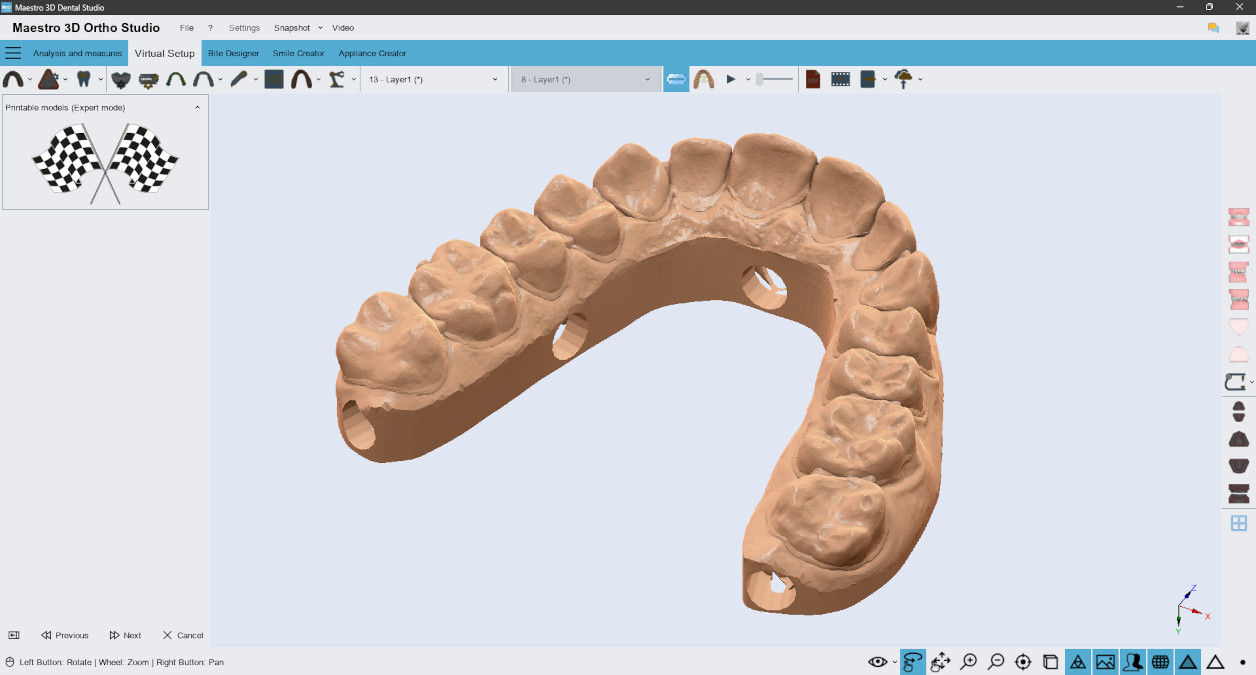 Deltaface, ArchForm, ONYXCEPH, 3Shape Ortho System, 3Shape Clear Aligner Studio, NemoCast, Nemotec, Ortho X Aligner, diorco, dentOne, 3dLeone, 3D Leone Designer, SureSmile Aligner, ulab, ulabsystems, blue sky bio, Maestro 3D, M3D, AGE Solutions, MDS500, Miglior software per ortodontia, Software per posizionamento Brackets, Modelli studio digitali, Prototipazione rapida per odontoiatria, 3D Scanner per gioielleria, Scanner Dentale, Miglior Scanner Dentale, Software ortodontico per allineatori trasparenti, Progettazione digitale di allineatori trasparenti, Software CAD/CAM ortodontico, Prototipazione rapida per ortodonzia, Guida per la produzione di allineatori, Soluzioni software per allineatori dentali, Creazione digitale di apparecchi ortodontici, Modellazione 3D per allineatori dentali, Stampa 3D diretta di allineatori trasparenti, Software per la correzione ortodontica, Tecnologia avanzata per allineatori, Software per la progettazione di espansori, Taglio automatico degli allineatori, Ortho Studio Software, Dental Studio Software, Bande ed Espansori Digitali, Bite-splint digitale, Paradenti digitale, Segmentazione automatica dei denti basata su Intelligenza Artificiale, Ortodonzia digitale basata su Intelligenza Artificiale, Software per il trattamento ortodontico, Software per allineatori dentali con intelligenza artificiale, Allineatori dentali digitali AI, Soluzioni software AI per allineatori dentali, Tecnologia AI per la correzione ortodontica Pianificazione ortodontica basata su intelligenza artificiale, Software per allineatori dentali basato su cloud, Soluzioni cloud per ortodonzia, Web viewer di casi ortodontici, Lingual Holding Appliance (LLHA), Trans-Palatal Arch (TPA)