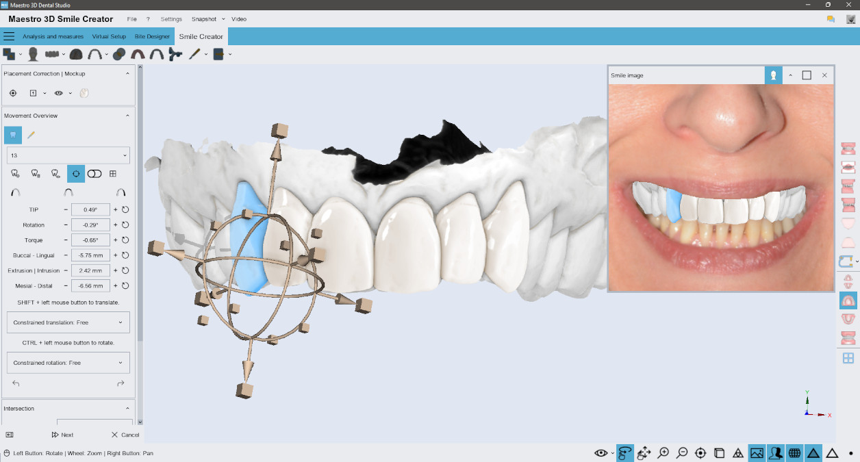 Maestro 3D Dental Studio Expert | Ortho Studio | Smile Creator | Appliance Creator