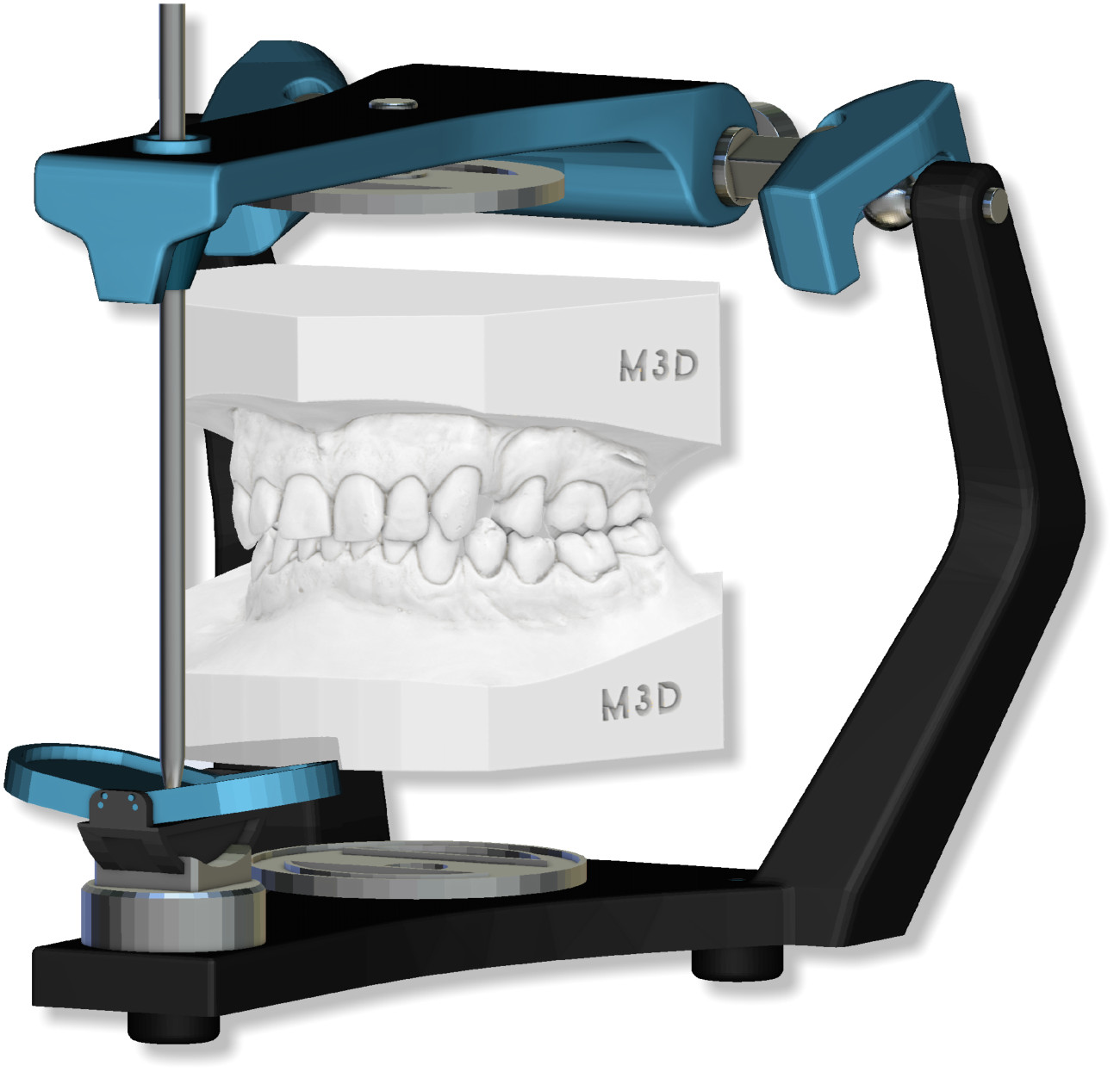 Deltaface, ArchForm, ONYXCEPH, 3Shape Ortho System, 3Shape Clear Aligner Studio, NemoCast, Nemotec, Ortho X Aligner, diorco, dentOne, 3dLeone, 3D Leone Designer, SureSmile Aligner, ulab, ulabsystems, blue sky bio, Maestro 3D, M3D, AGE Solutions, MDS500, Meilleur logiciel orthodontique, Logiciel de placement de brackets, Modèles d'étude numériques, Prototypage rapide pour la dentisterie, Scanner 3D pour la joaillerie, Scanner dentaire, Meilleur scanner dentaire, Logiciel orthodontique pour les aligneurs transparents, Conception numérique d'aligneurs transparents, Logiciel CAD/CAM orthodontique, Prototypage rapide pour l'orthodontie, Guide de production d'aligneurs, Solutions logicielles pour les aligneurs dentaires, Création numérique d'appareils orthodontiques, Modélisation 3D pour les aligneurs dentaires, Impression 3D directe d'aligneurs transparents, Logiciel de correction orthodontique, Technologie avancée pour les aligneurs, Logiciel de conception d'expandeurs, Découpe automatique des aligneurs, Logiciel Ortho Studio, Logiciel Dental Studio, Bandes numériques et expandeurs, Gouttière dentaire numérique, Protège-dents numérique, Segmentation automatique des dents basée sur l'intelligence artificielle, Orthodontie numérique basée sur l'intelligence artificielle, Logiciel de traitement orthodontique, Logiciel d'aligneurs dentaires basé sur l'intelligence artificielle, Aligneurs dentaires numériques basés sur l'IA, Solutions logicielles d'IA pour les aligneurs dentaires, Technologie d'IA pour la correction orthodontique, Planification orthodontique basée sur l'intelligence artificielle, Logiciel d'aligneurs dentaires basé sur le cloud, Solutions cloud pour l'orthodontie, Visionneuse web pour les cas orthodontiques, Lingual Holding Appliance (LLHA), Trans-Palatal Arch (TPA)