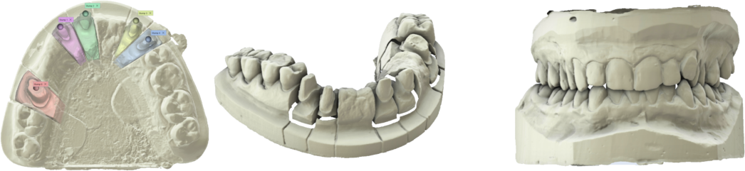 Maestro 3D MDS 500 | 3D Dental Scanner | 3D Jewelry Scanner | Smart Impression Scanning | Texture Color Super Imposition